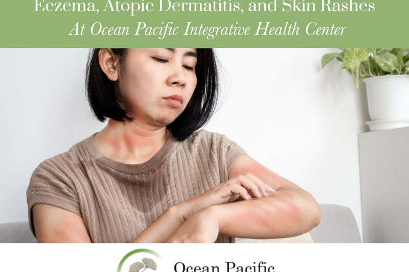 Comprehensive Care for Eczema_ Atopic Dermatitis_ and Skin Rashes at Ocean Pacific Integrative Health Center
