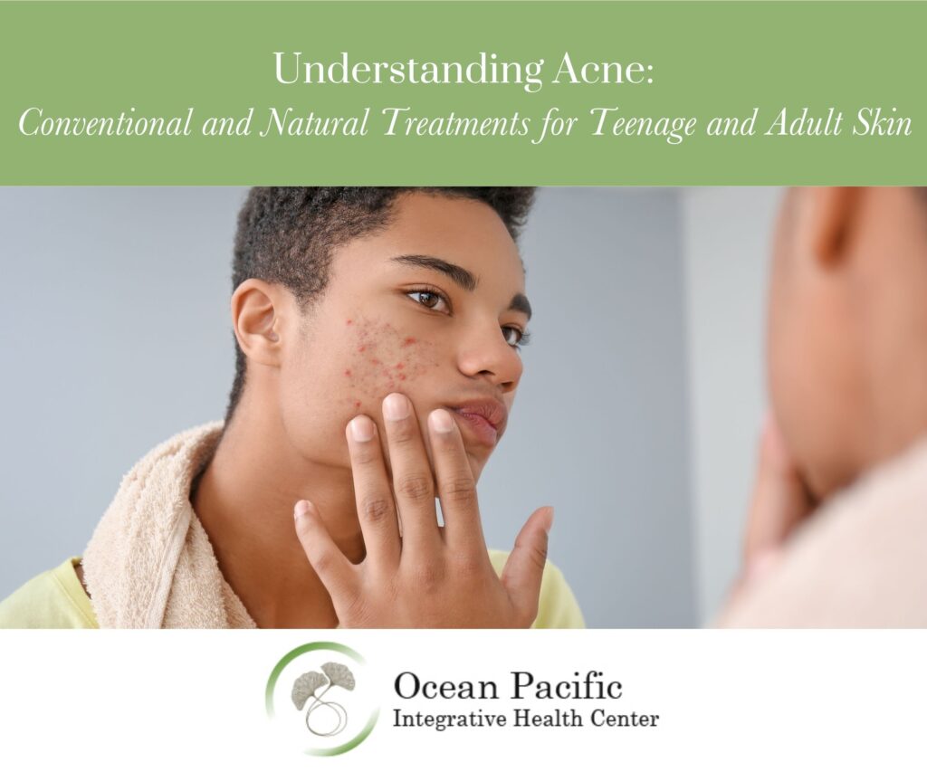 Understanding AcneConventional and Natural Treatments for Teenage and Adult Skin