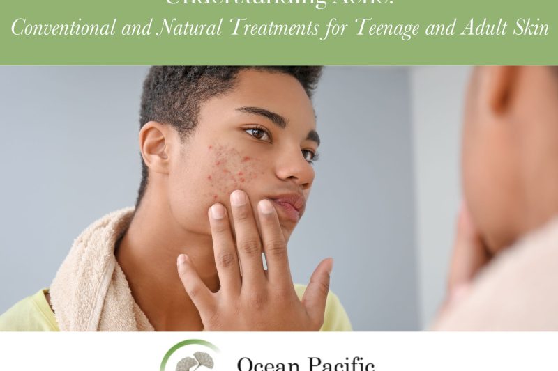 Understanding AcneConventional and Natural Treatments for Teenage and Adult Skin